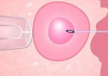 科学避免色盲基因，美国试管婴儿技术，生一个健康的孩子