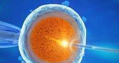 去美国办试管婴儿需要多少钱？