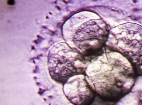 宁波第一医院试管婴儿多少钱一次？